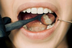 外贸电动牙刷采购策略：加工厂选择指南